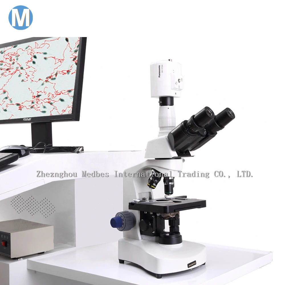 Mobile Sperm Analyzer Semen Analysis