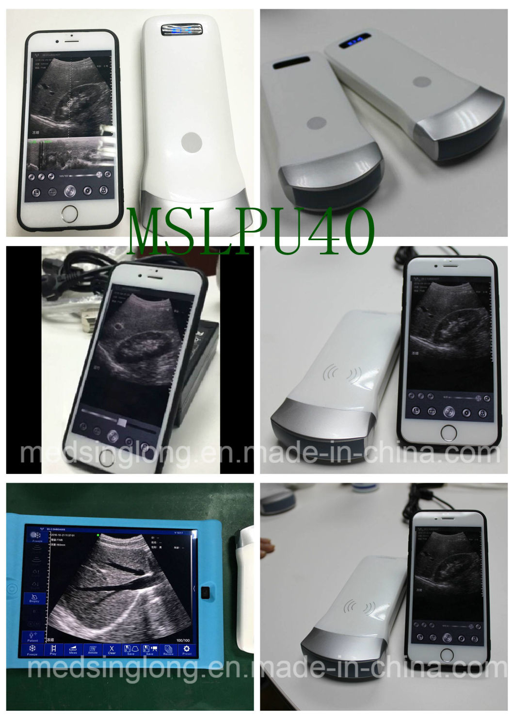 Full Digital Handheld Ultrasound Scanner with Wireless Probe & Ultrasonic Scanner Mslpu40