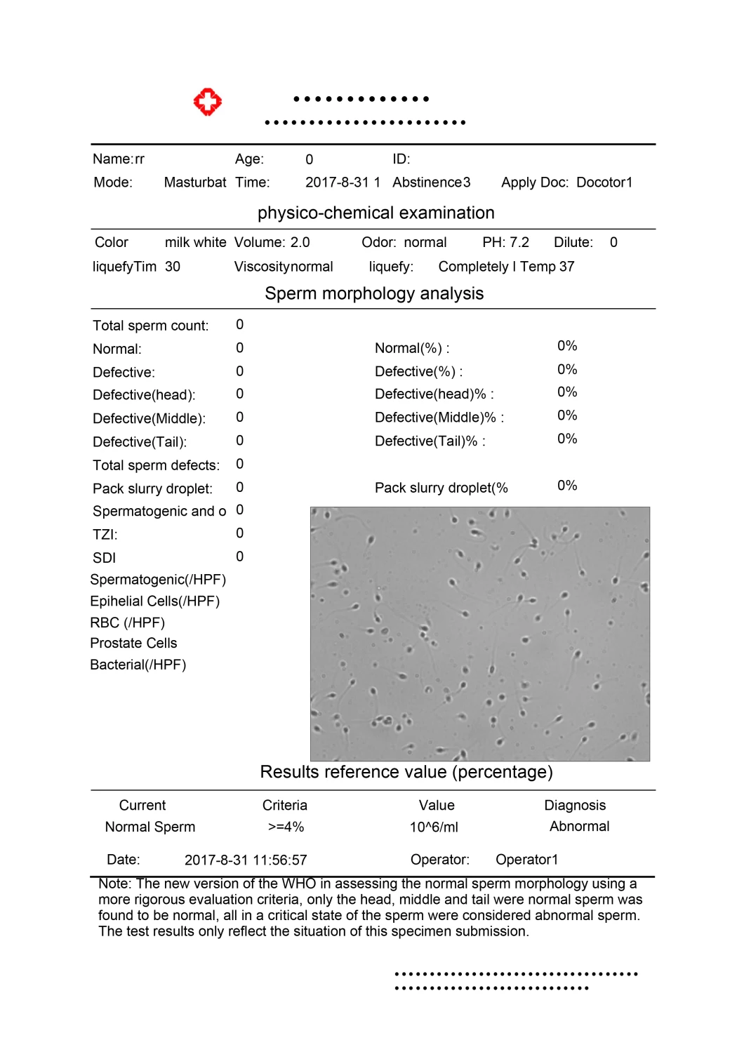 Hc-B028A Top Advanced Automatic Sperm Quality Analyzer/Casa/Semen Analysis Equipment
