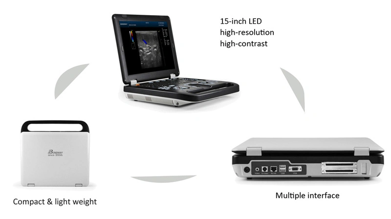 Full Digital Color Doppler Ultrasound System Es250 with 128-Element Transducers