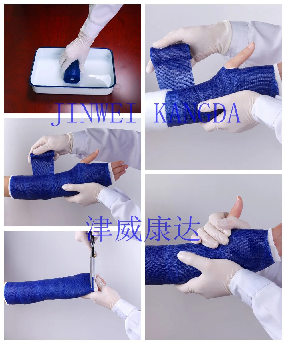 Cast Tape, Fiberglass Casting Tape & Molding Material with Low Tack Resin, Immobilization & Mold Creation for Fractures