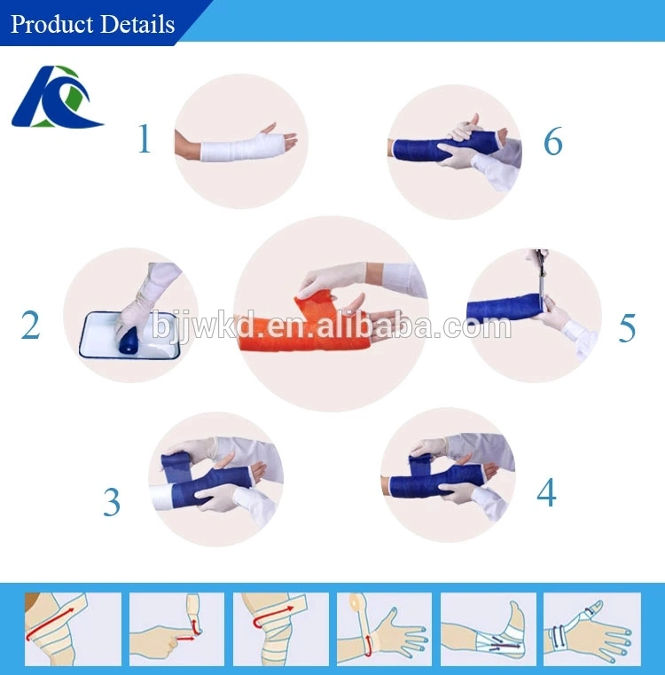 Disposable Orthopedic Fiberglass Casting Tape for Medical Applications