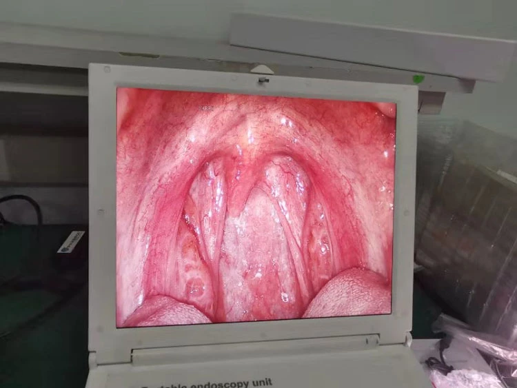 My-P038b Medical Hospital Surgical Instrument Portable Endoscope Camera Video Endoscopy