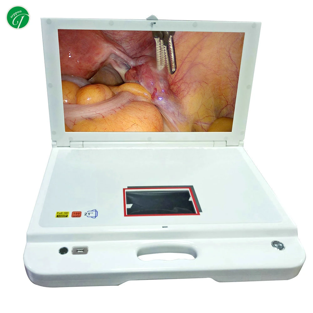 All in One Medical 1080P Endoscope Camera System with Cold Light Source