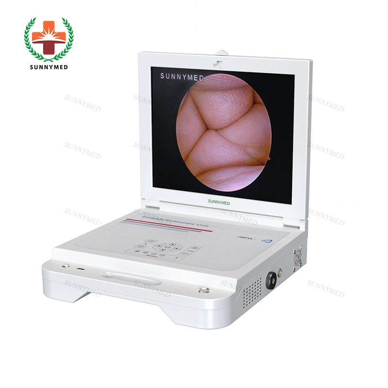 Sy-PS045n Hospital Ent Endoscope Endoscopy Rigid Endoscope System