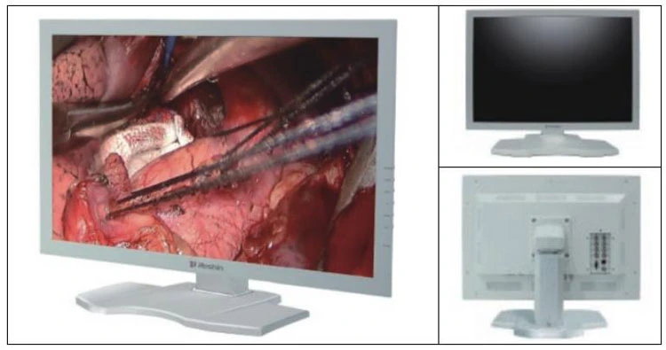 My-P006g Hospital Equipment Medical Endoscopy Trolley Video Electronic Colonoscope Gastroscope
