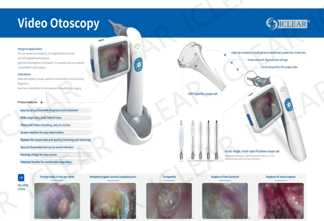 Portable HD Digital Video Ent Endoscope for Otoscope/Sinuscope/Laryngoscope