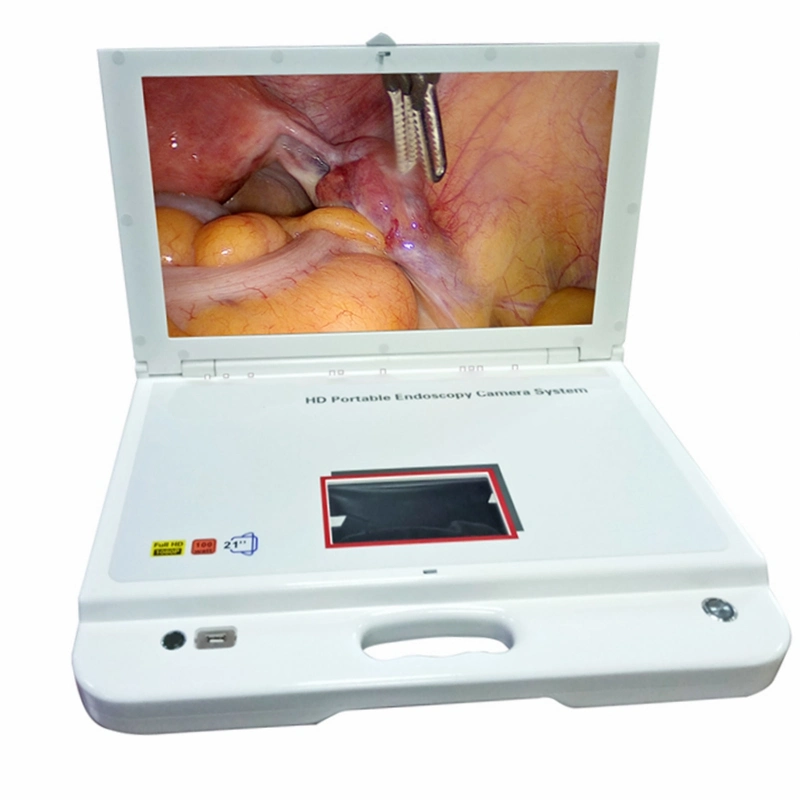 Medical Portable HD Endoscopy Unit Portable Endoscopy Camera System with Light Source for Hysteroscopy, Arthroscopy, Ent, Examination and Surgery