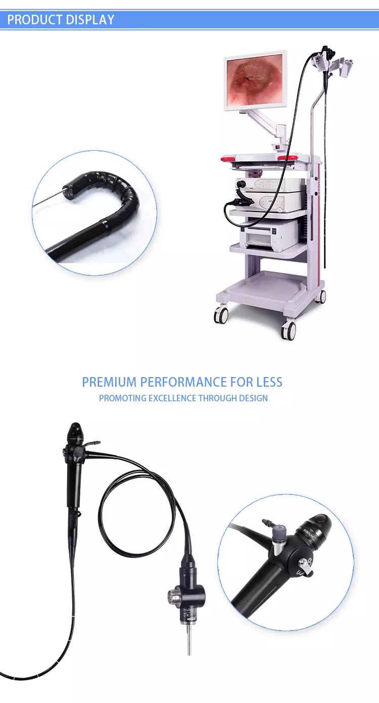 Medical Optical Rigid Ent Mobile Trolley Endoscope System, Surgery Flexible Video Endoscopy Complete Set with Camera