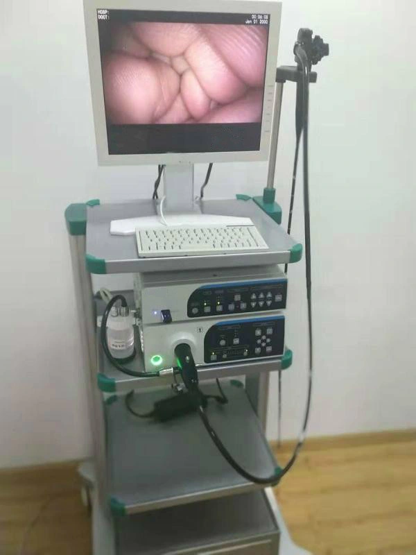 Medical Equipment Endoscopy System High Resolution Electronic Video Gastroscope and Colonoscope