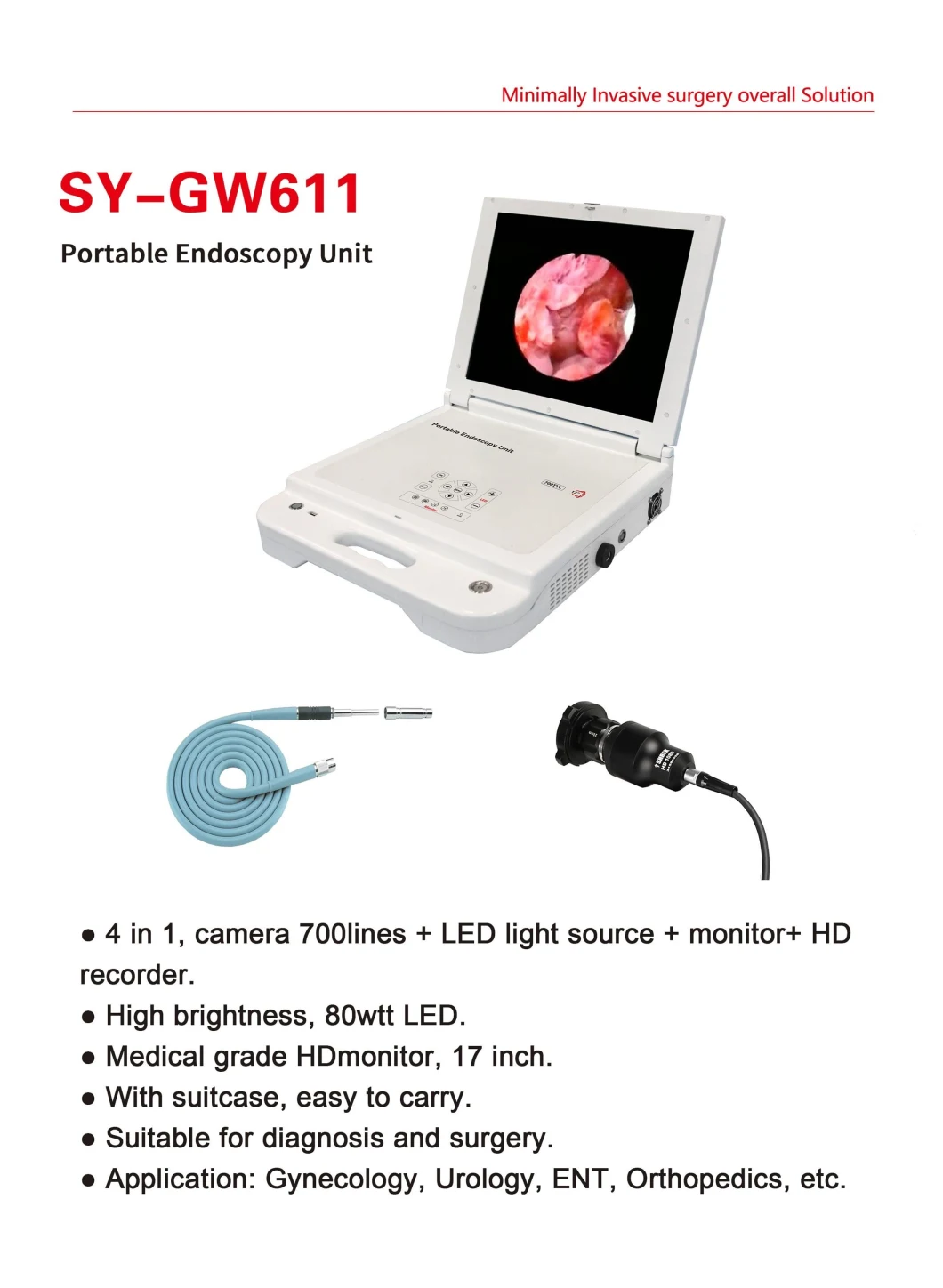 All-in One Portable Endoscopic Camera Ent Endoscope / Ent Arthroscopy Cystoscopy Hysterosco Price for Human
