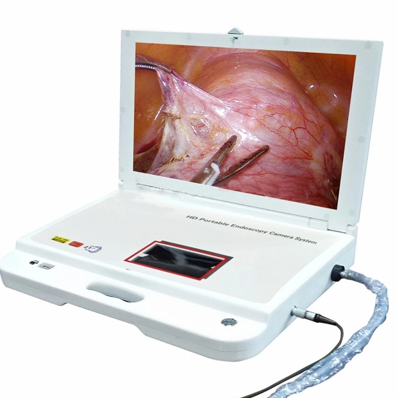 Electronic Gastroscope Instrument with SD Record Card with Rigid Endoscopy Connection Bronchoscope Colonoscope