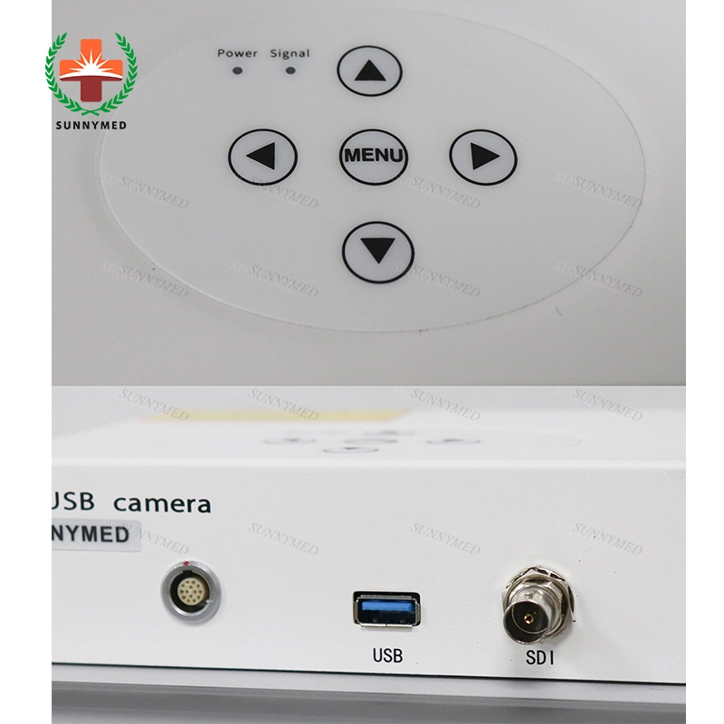 Sy-P031HD2 Portable 1080P Full HD USB Medical Endoscope Camera