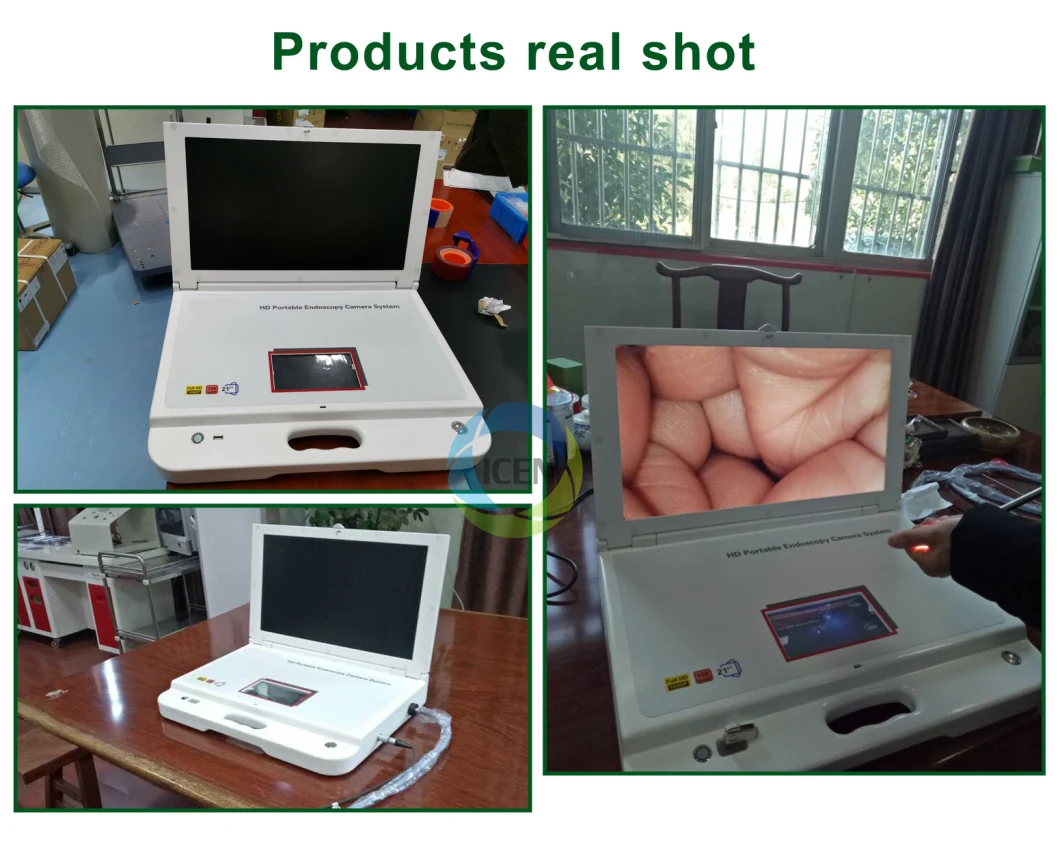 IN-GW603 Endoscope & surgical Monitor medical portable endoscope camera System