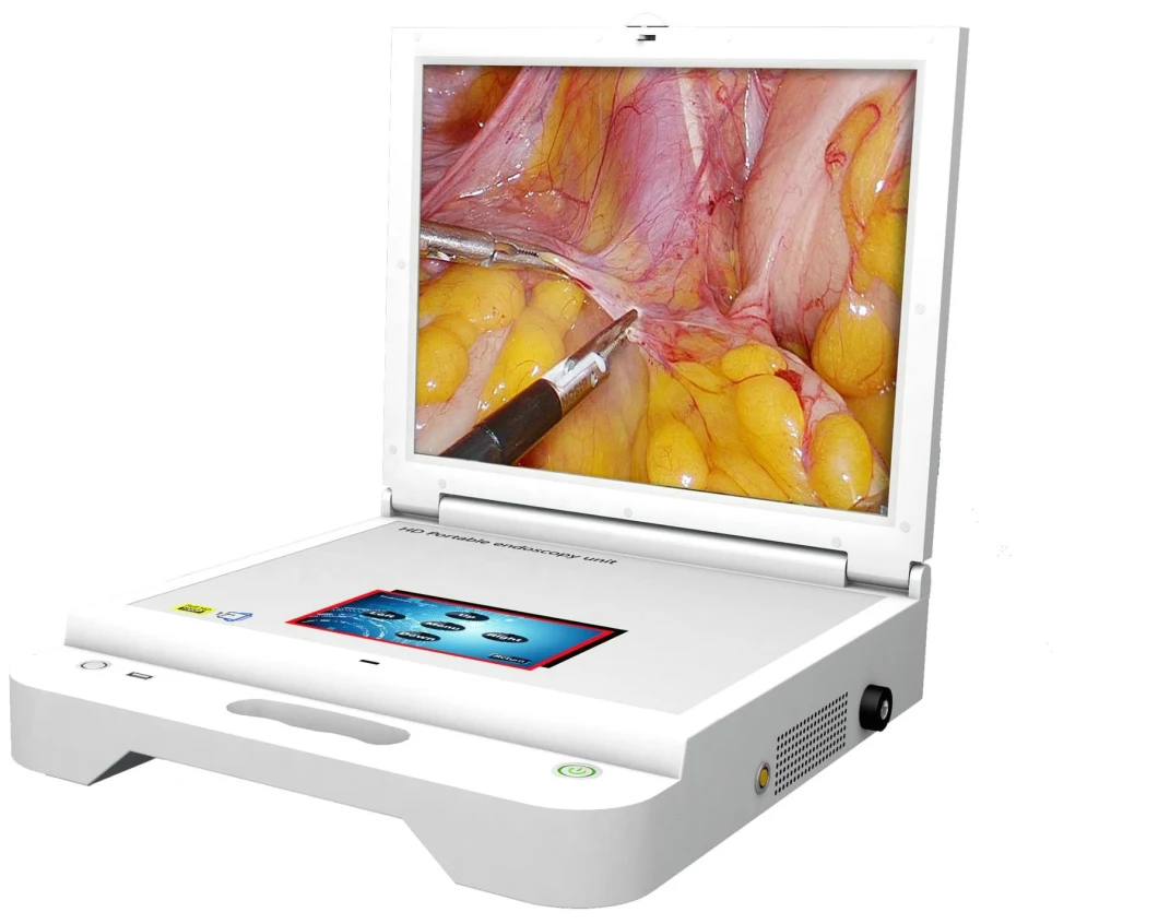 HD Endoscope Camera Aio Endoscopy System for Laparosocpe/Ent/Arthroscope/Urology