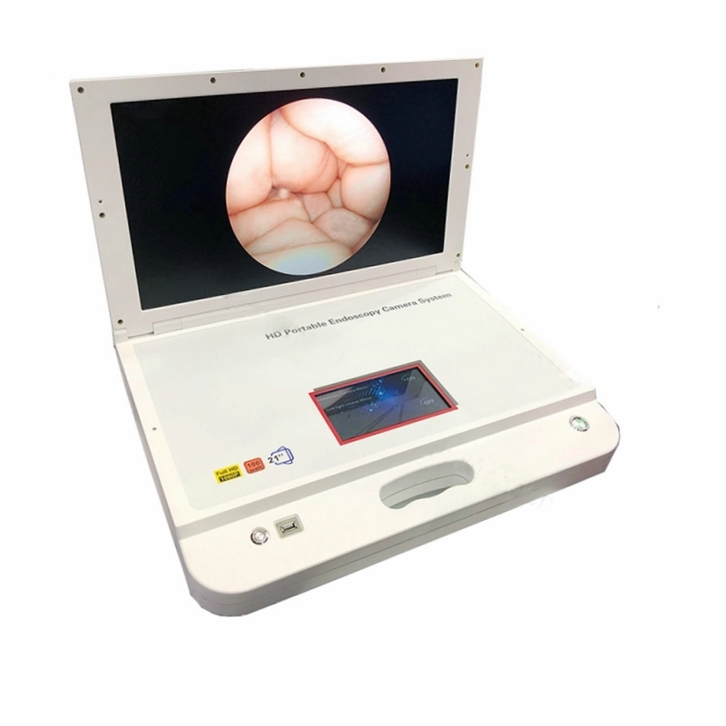Integrated Professional Endoscopy Camera System Portable Ent Endoscopic with Light Source