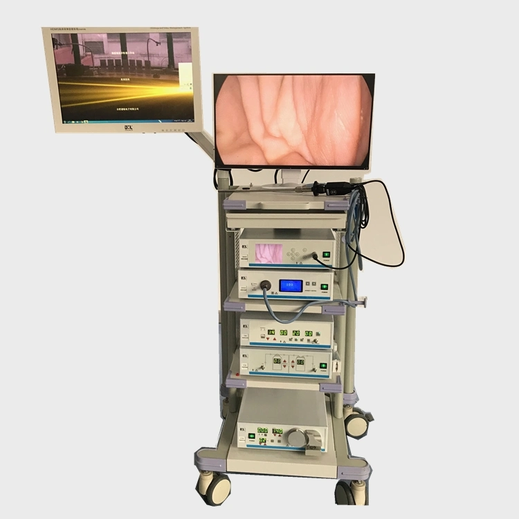 Medical Hospital Camera System Laparoscopic Complete Set Endoscopic Tower for Gallbladder Surgery