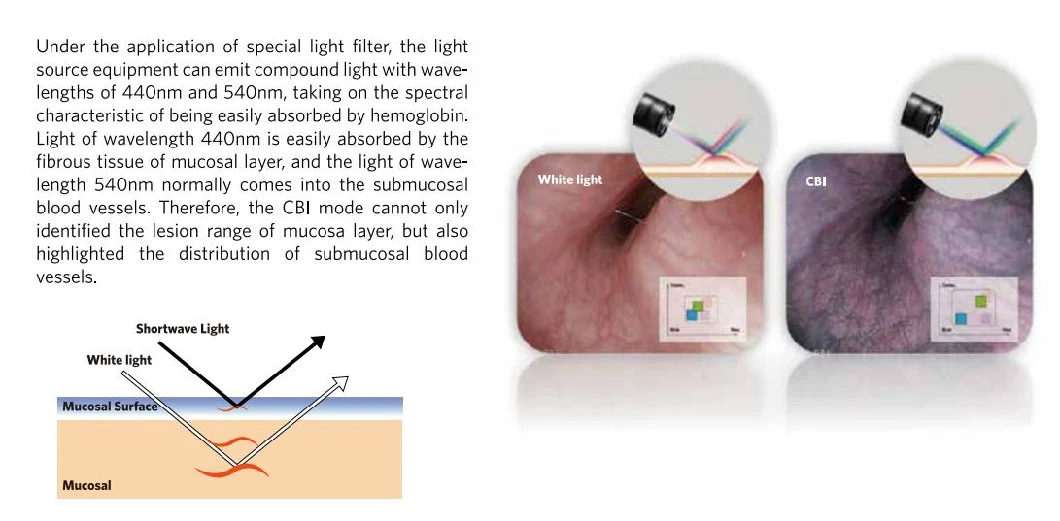 Medical Endoscope Camera Surgery Camera System Endoscopy/Endoscope