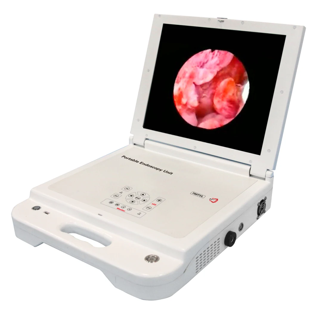 HD-7021 Medical Portable Camera System Endoscopy Camera with LED Cold Light Source for Hospital
