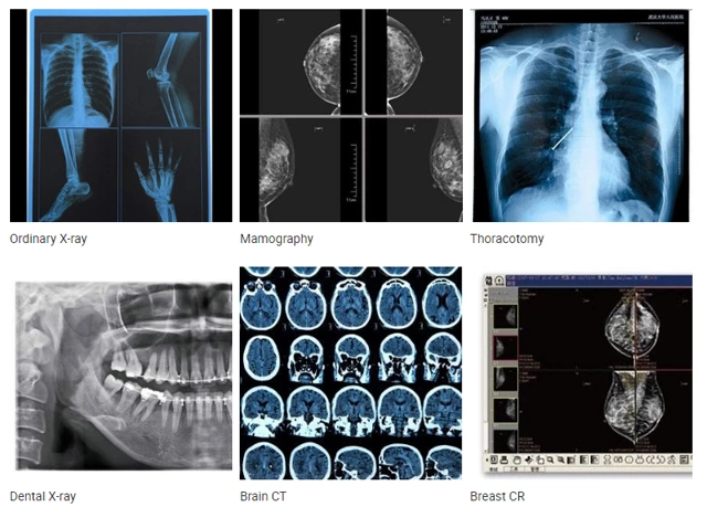 210*297mm Dental X-ray Film, Inkjet Ultrasound Films
