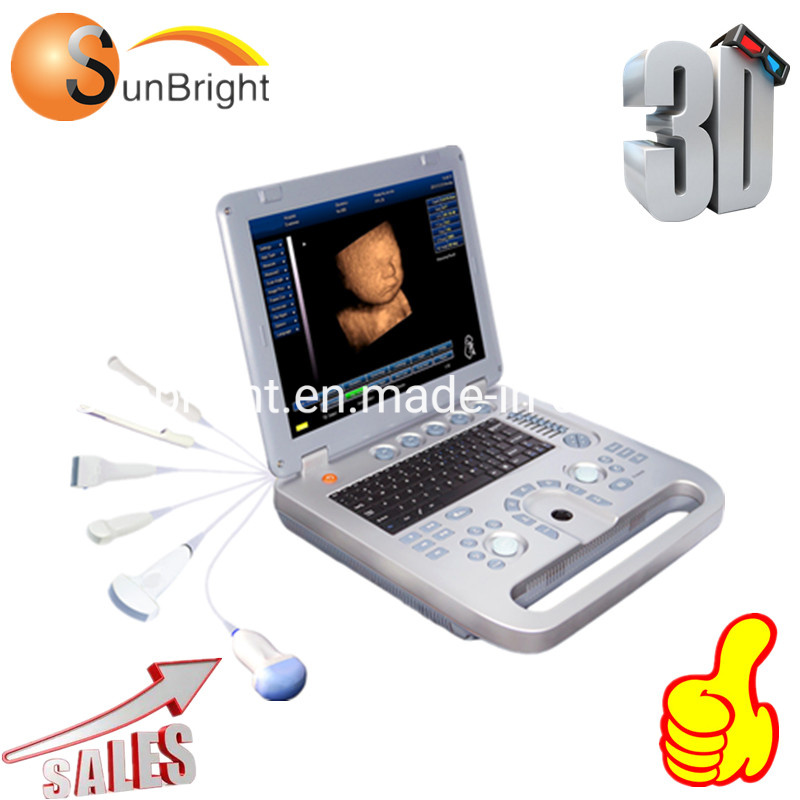 Vascular Ultrasound Elastography Laptop Machine Portable Color Doppler