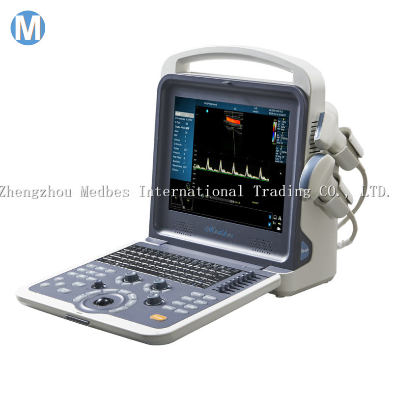 Laptop Portable Color Doppler Vascular Ultrasound Scanner