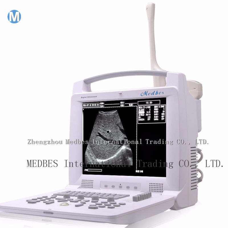 Trolly B Ultrasound Diagnosis Machine