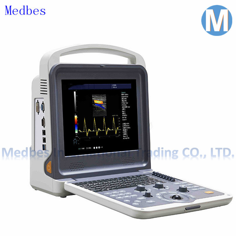 Vascular Cardiac Laptop Portable Color Doppler Ultrasound Scanner