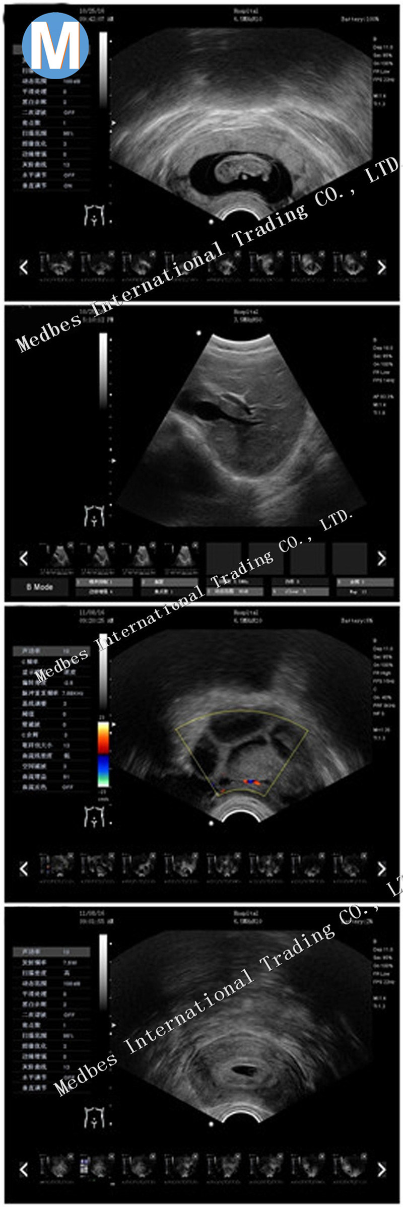 Vascular Cardiac Laptop Portable Color Doppler Ultrasound Scanner