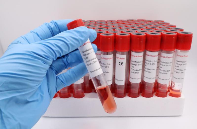 CE Approved Universal Transport Medium Tube Viral Transport Media