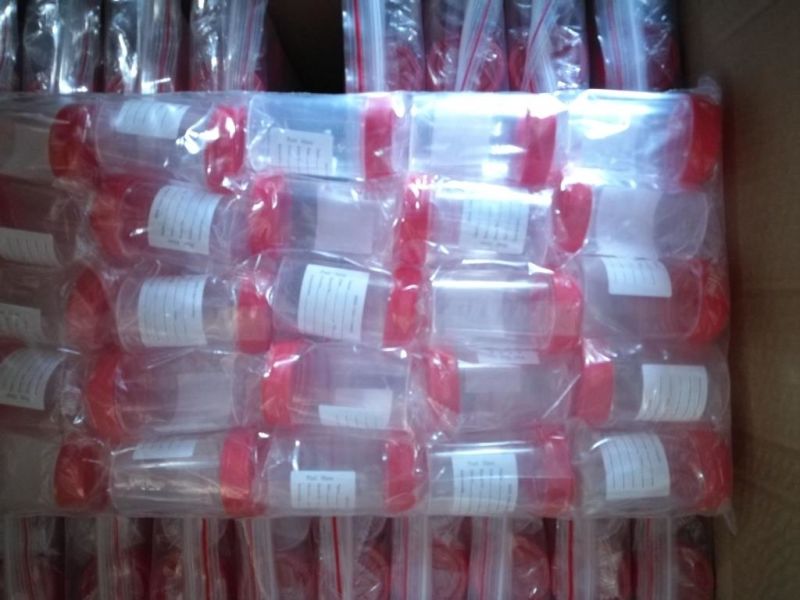 Sterilized Urine Cup Urine Container with Ce and ISO Approved