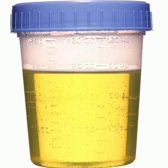 Super Quality Sterile Specimen Urine Cup Collection Container 60/100ml
