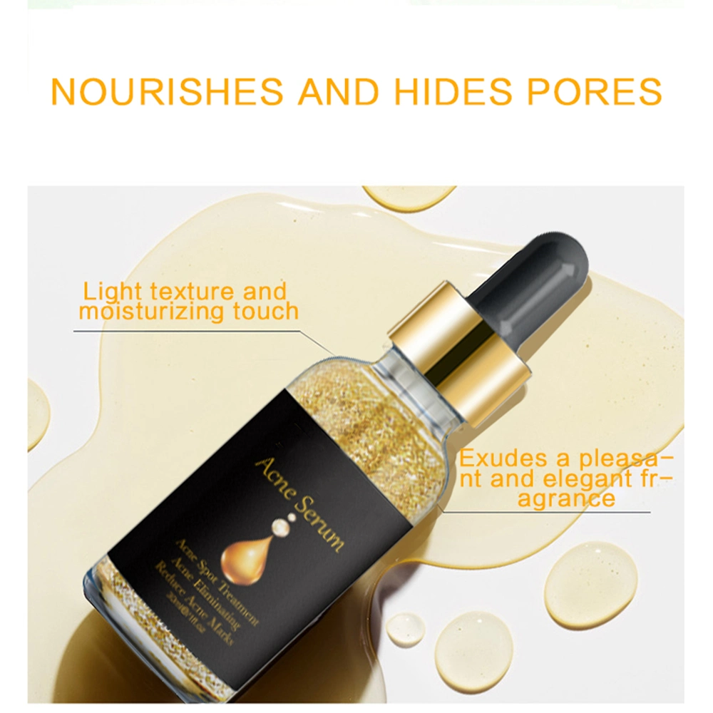 24K Gold Smooth Skin Anti Acne Serum Oil Control Pore Minimizer Acne Serum