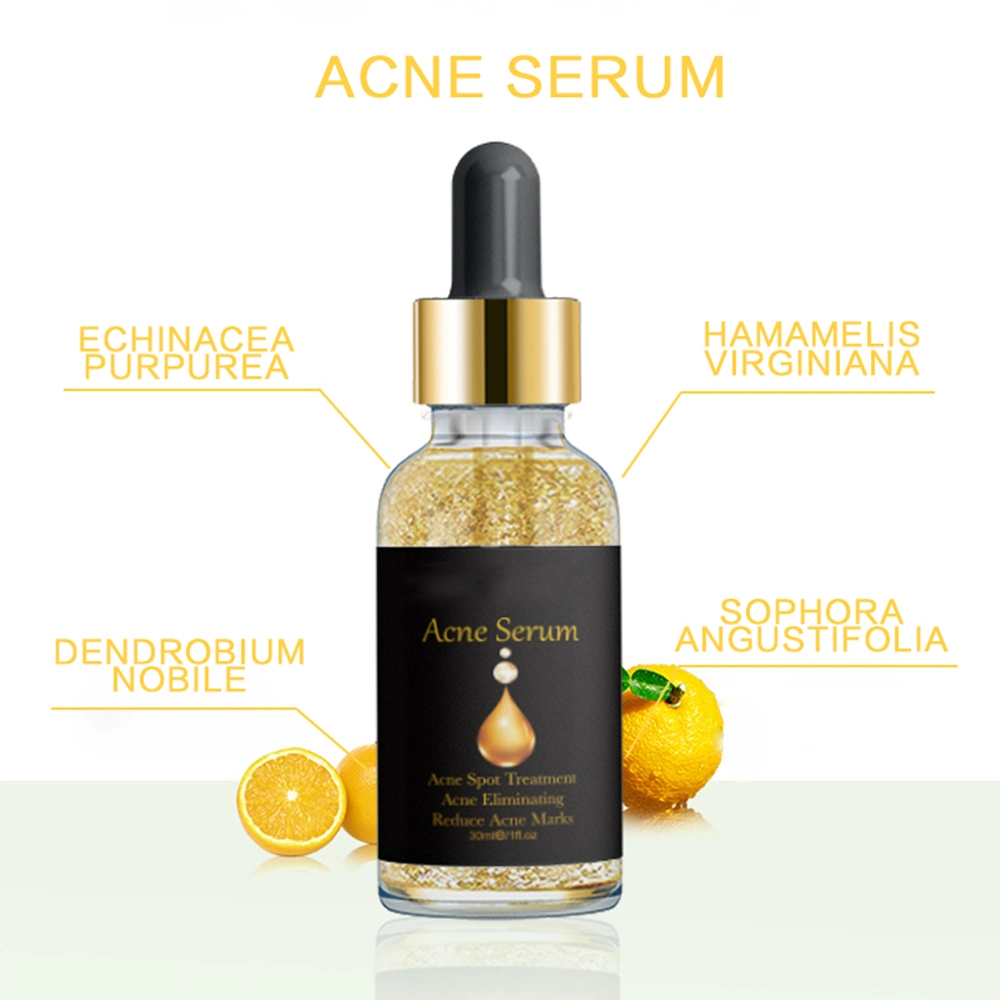 24K Gold Smooth Skin Anti Acne Serum Oil Control Pore Minimizer Acne Serum