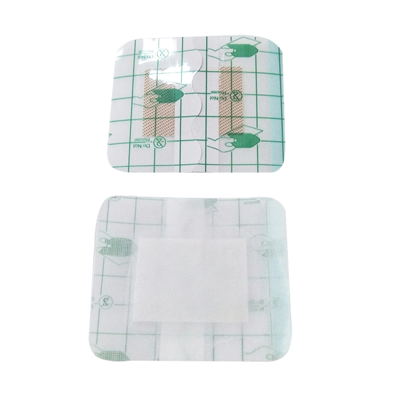 Disposable Transparent PU Wound Dressing Pad Surgical Wound Dressing Bandage Q44 - China Wound Dressing, Non-Woven Wound Dressing
