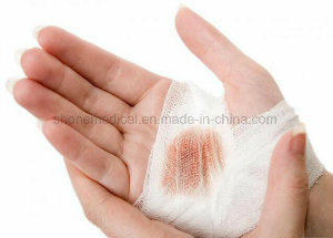First Aid Conforming Bandage for Medical Supply or Wound Care