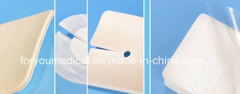 High Absorbable Foam Dressing with Adhesive Border for Diabetes Wound