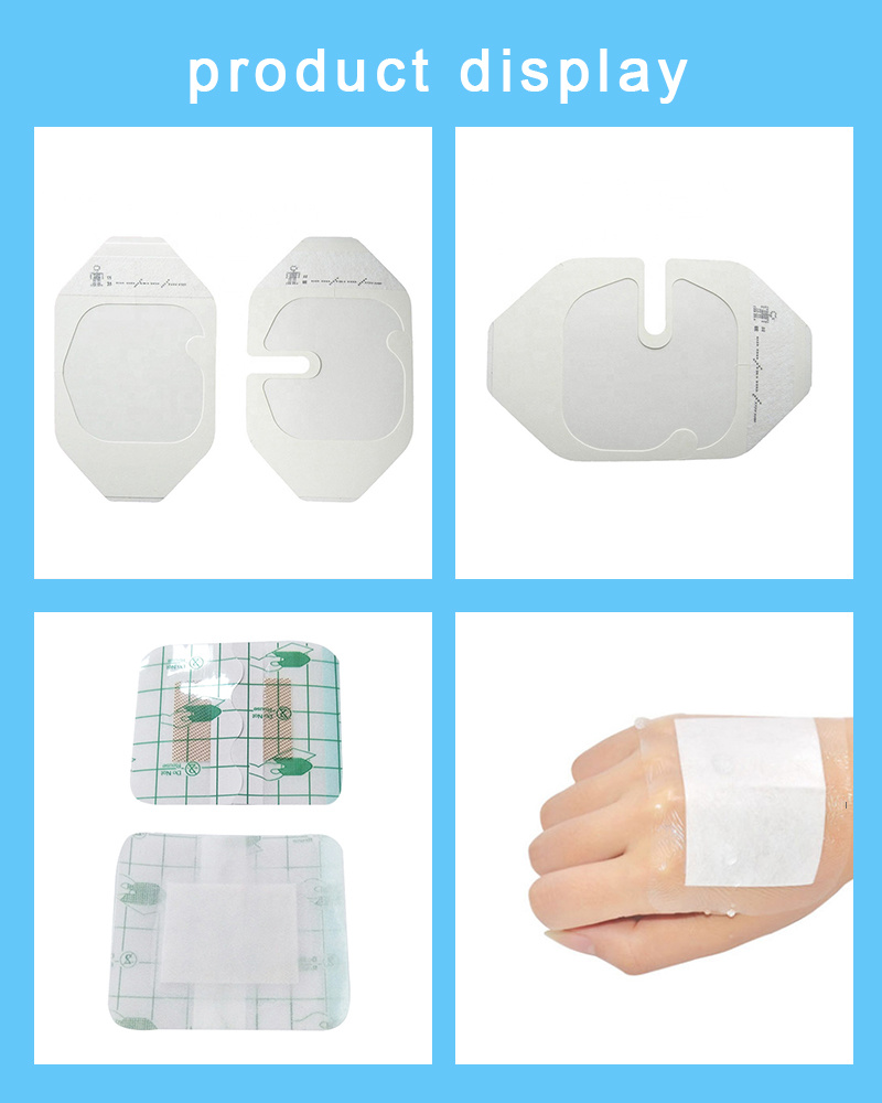 ISO Disposable Medical Waterproof Transparent PU Wound Care Band-Aid Adhesive Bandage