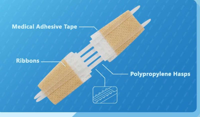 Noninvasive Zip Stitch Wound Closure Device Without Suture for Wound Care Pwf1001 2cm