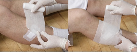 Medical PBT Conforming Bandage 10cm*4.5m