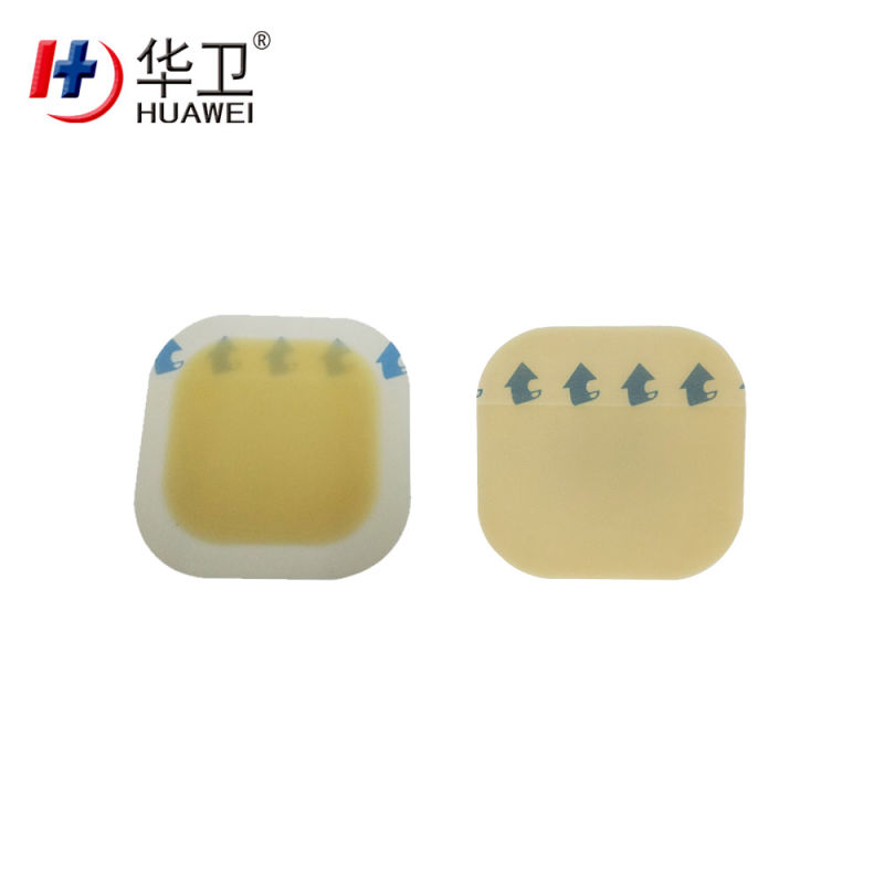 Hydrocolloid Wound Dressing with Thin Border for Burn Exudative Wounds China Factory OEM