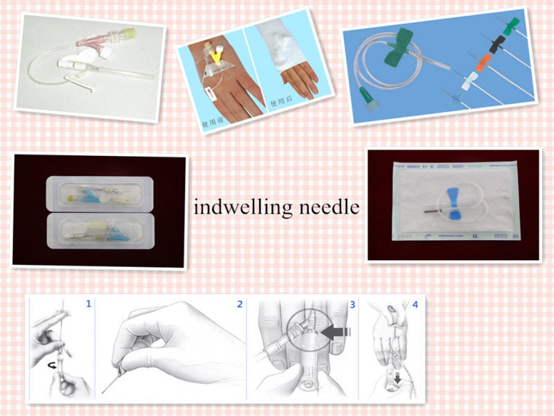 Disposable Sterile Intravenous Catheter Is Used for Medical Treatment