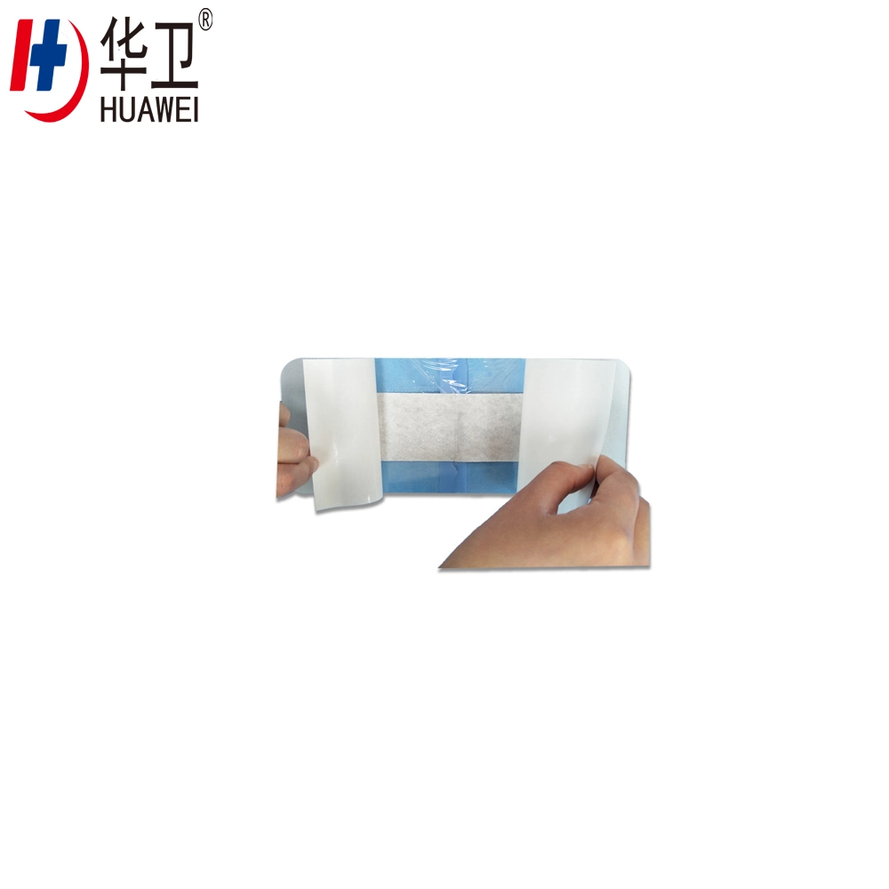 Types of Suture, Chitosan Wound Dressing Tape