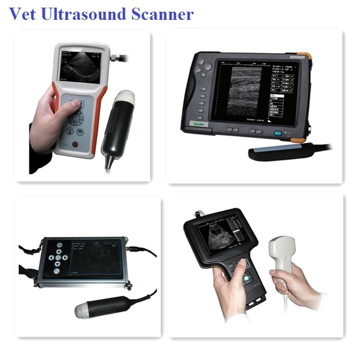 Opthalmic Ultrasound Scanner for Eyes a / B Ultrasound Scanner (HO-500)