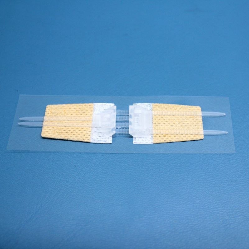 Top Ce Approved Medical Skin Stretching and Secure Wound Closure Device for Wounds