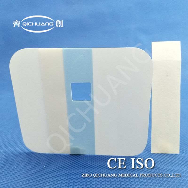 Medical Supplies Disposable Wound Dressing Transparent Waterproof Anti-Allergy High-Permeability
