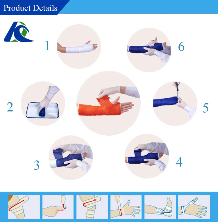 Orthopedic Casting Tape Bandage Wound Dressing