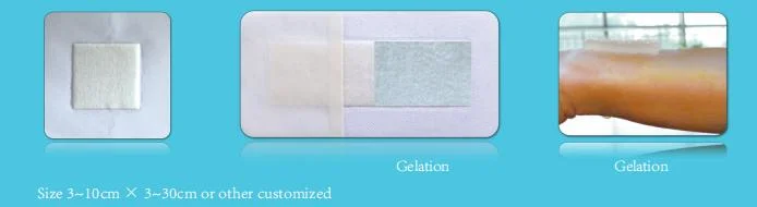 Alginate Wound Dressing Can Absorb Wound Exudate, No Adhesion, No Pain, No Scar Formation