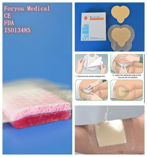 Low Adherent Dressing Hydrogel Wound Care Hydrogel Dressing