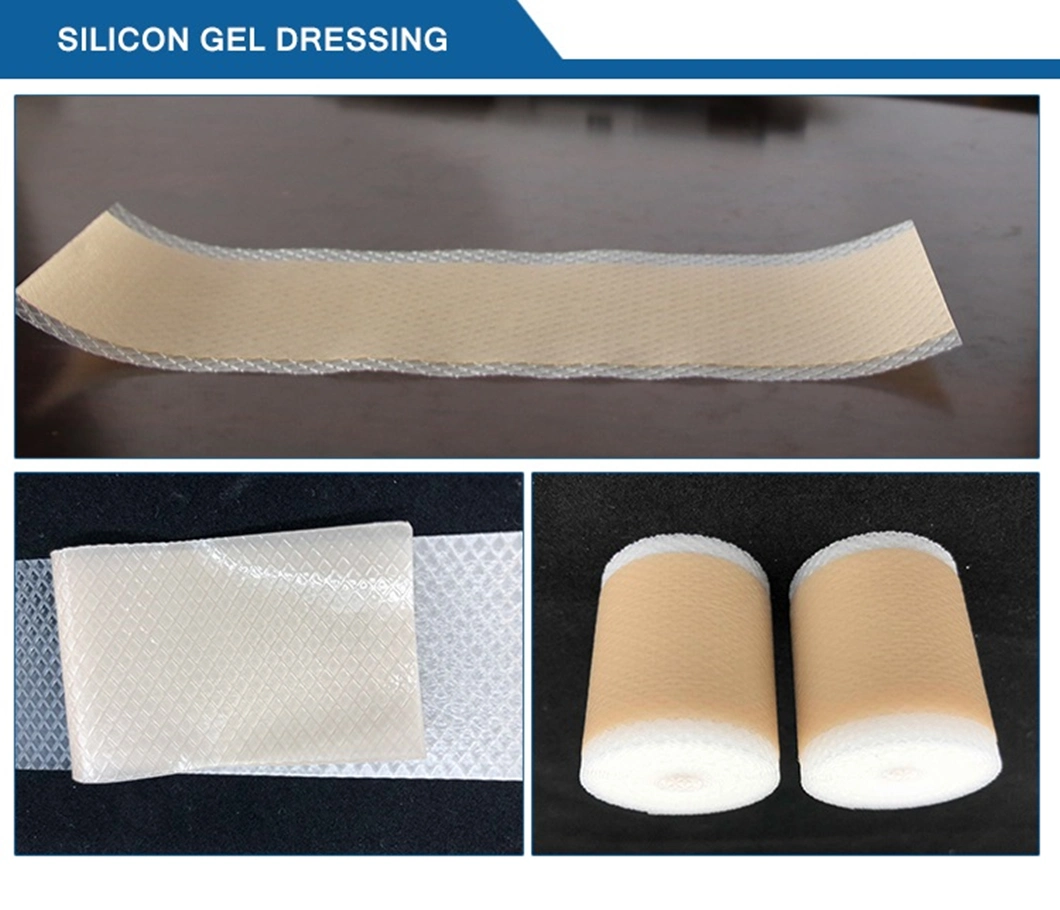 High Absorbent Non-Woven Wound Dressing Calcium Alginate Wound Dressing